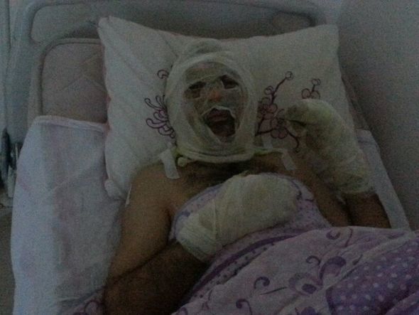 Житель Агдаша поджег себя после ссоры с полицейским