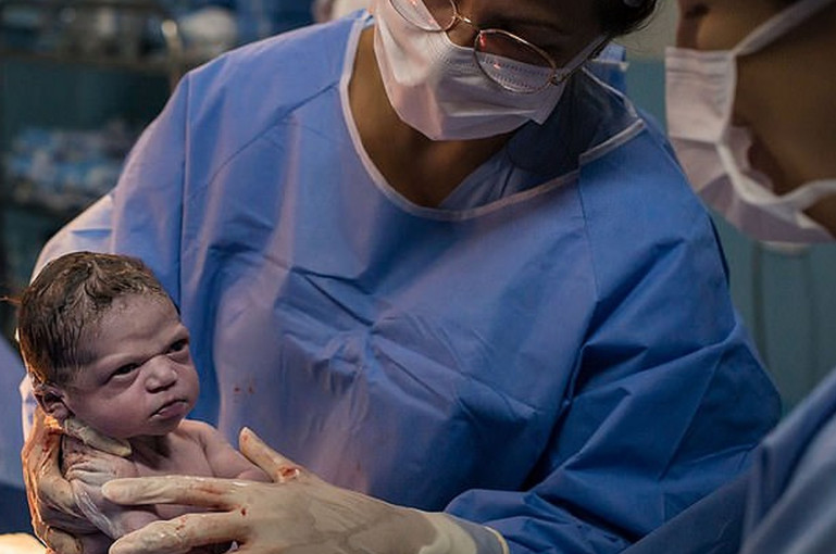 Բրազիլիայում նորածինը խոժոռ հայացքով նայել է իրեն «լացացնել» փորձող բժշկին (լուսանկարներ)