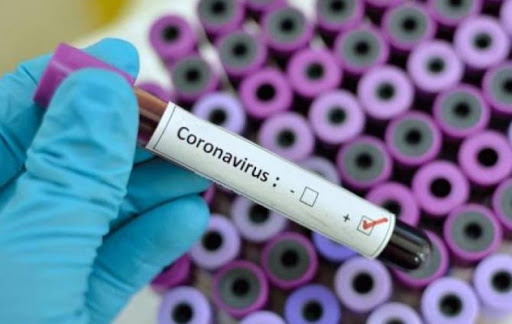 Число подтвержденных случаев коронавируса в Армении достигло 290