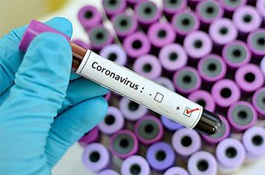 Число подтвержденных случаев коронавируса в Армении достигло 482