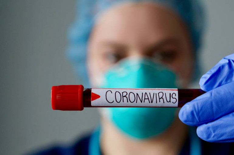 В Армении подтверждено два новых случая заражения коронавирусом