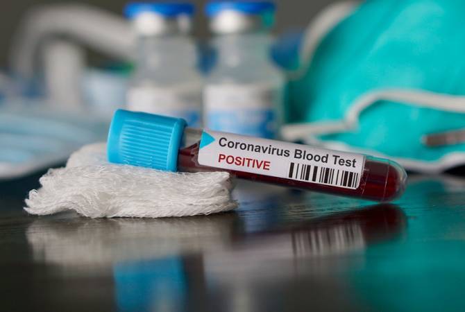 В Армении зарегистрирована третья за сутки смерть от коронавируса