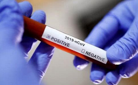 В Грузии проводят «агрессивное тестирование» военных на коронавирус