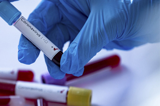 В Арцахе подтверждены три новых случая заражении коронавирусом