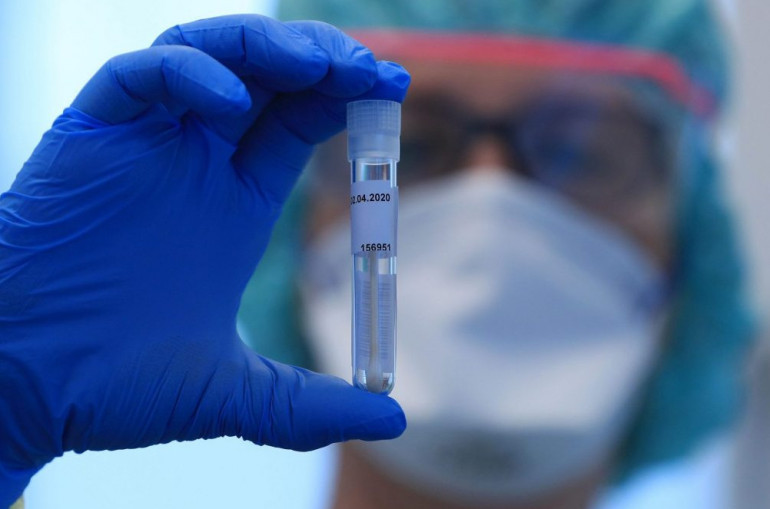 В Иране выявили около 2,4 тысячи новых случаев заражения коронавирусом