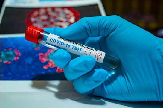 В Армении число зараженных коронавирусом увеличилось на 308 человек, скончались 6 человек