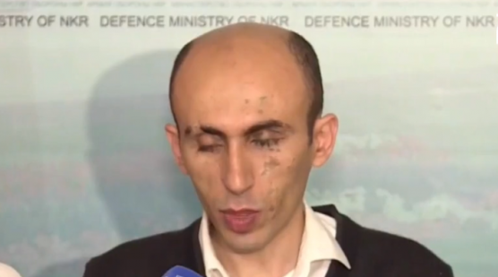 Ադրբեջանը, կիրառել է Պոլոնեզ տիպի հրթիռներ․ Արցախի ՄԻՊ (տեսանյութ)