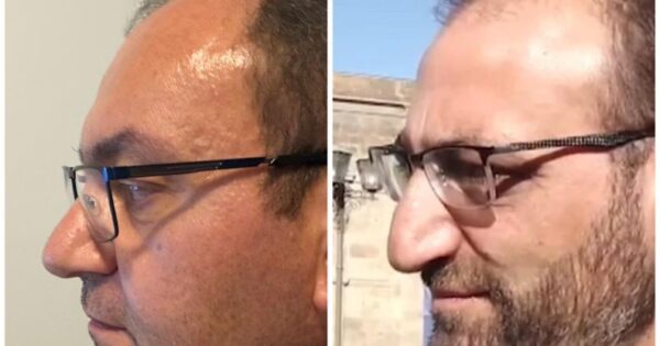 Արսեն Բաբայանն ԱԲ-ի օգնությամբ ծաղրել է ՔԿ փորձաքննությունը