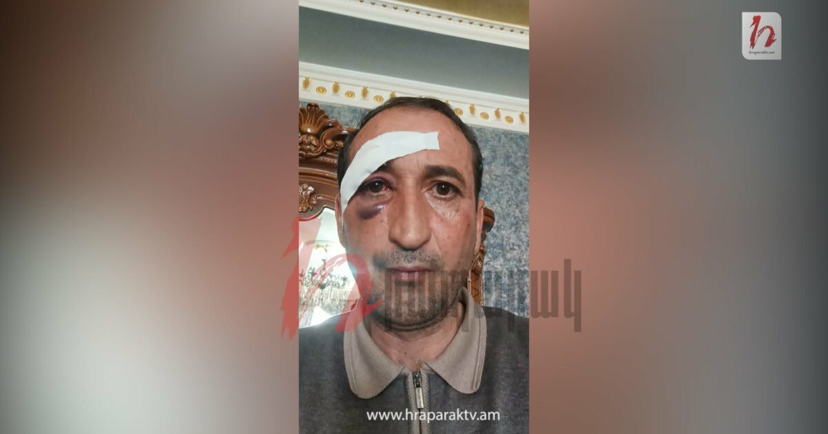 Ծեծողը ծեծվողից ներողություն է խնդրել․ «Հրապարակ»